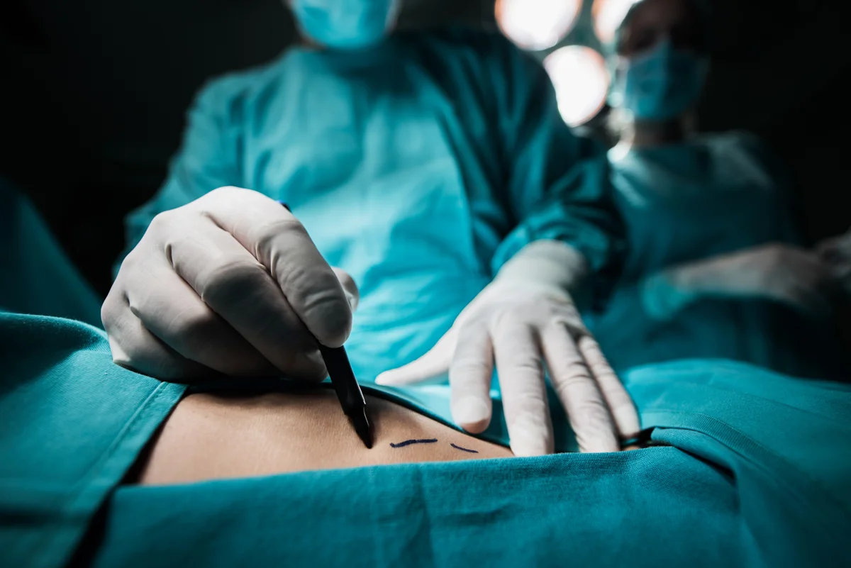An overview of  surgical site infection treatment guidelines