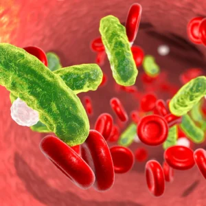Multidisciplinary Approach to Septicemia and Septic Shock: From the Emergency Department to the ICU